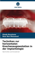 Techniken zur horizontalen Knochenaugmentation in der Implantologie