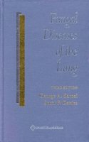 Fungal Diseases of the Lung