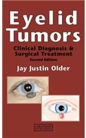 Eyelid Tumors