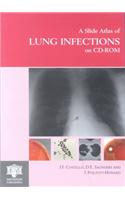 A Slide Atlas of Lung Infections on CD-ROM