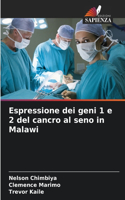 Espressione dei geni 1 e 2 del cancro al seno in Malawi