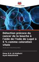 Détection précoce du cancer de la bouche à l'aide de l'iode de Lugol à 5 % comme coloration vitale