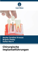 Chirurgische Implantatführungen