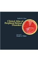 Clinical Atlas of Peripheral Retinal Disorders