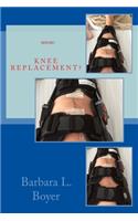 Read This BEFORE Your Knee Replacement