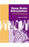 Deep Brain Stimulation and Epilepsy