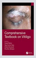 Comprehensive Textbook on Vitiligo