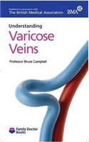 Understanding Varicose Veins