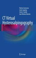 CT Virtual Hysterosalpingography