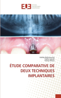 Étude Comparative de Deux Techniques Implantaires
