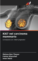 Ki67 nel carcinoma mammario