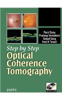 Step by Step: Optical Coherence Tomography