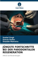 Jüngste Fortschritte Bei Der Parodontalen Regeneration