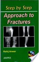 Step by Step Approach To Fractures