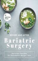 Before and After Bariatric Surgery