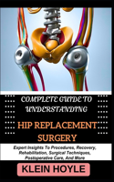 Complete Guide to Understanding Hip Replacement Surgery