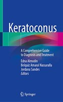 Keratoconus