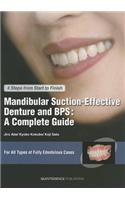 Mandibular Suction-effective Denture and BPS: A Complete Guide