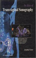 Atlas of Transvaginal Sonography