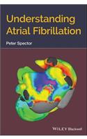 Understanding Atrial Fibrillation