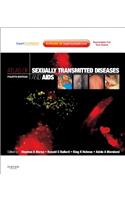 Atlas of Sexually Transmitted Diseases and AIDS