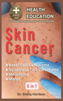 Skin Cancer: Basal Cell Carcinoma, Squamous Cell Carcinoma, Melanoma Skin Cancer, Mole: Types, Symptoms, Causes, Diagnosis, Treatment, Medications, Prevention & 