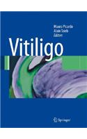 Vitiligo