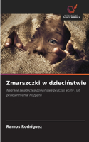 Zmarszczki w dzieciństwie