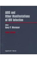 AIDS and Other Manifestations of HIV Infection