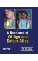 Handbook of Vitiligo and Colour Atlas