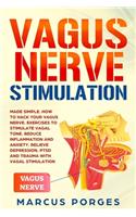 Vagus Nerve Stimulation