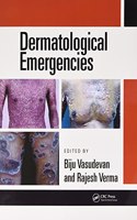 Dermatological Emergencies