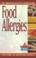Food Allergies: The Nutrition Now Series(5 Nutrition Now)