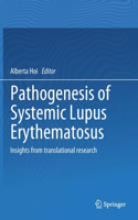 Pathogenesis of Systemic Lupus Erythematosus