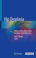 Hip Dysplasia