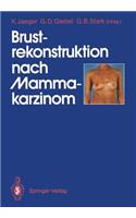 Brustrekonstruktion Nach Mammakarzinom