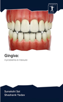 Gingiva