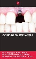 Oclusão Em Implantes