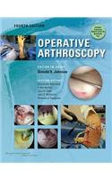 Operative Arthroscopy