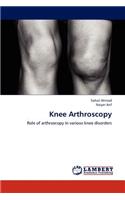 Knee Arthroscopy