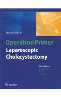 Laparoscopic Cholecystectomy