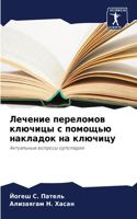 Лечение переломов ключицы с помощью накл&#1072