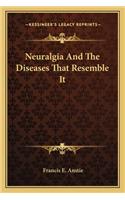 Neuralgia And The Diseases That Resemble It