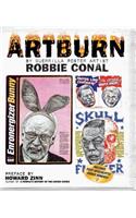 Artburn