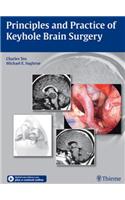 Principles and Practice of Keyhole Brain Surgery