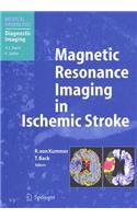 Magnetic Resonance Imaging in Ischemic Stroke