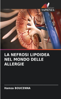 Nefrosi Lipoidea Nel Mondo Delle Allergie