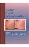 Laser Skin Rejuvenation