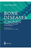 Bone Diseases