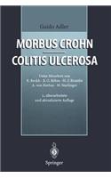 Morbus Crohn - Colitis Ulcerosa